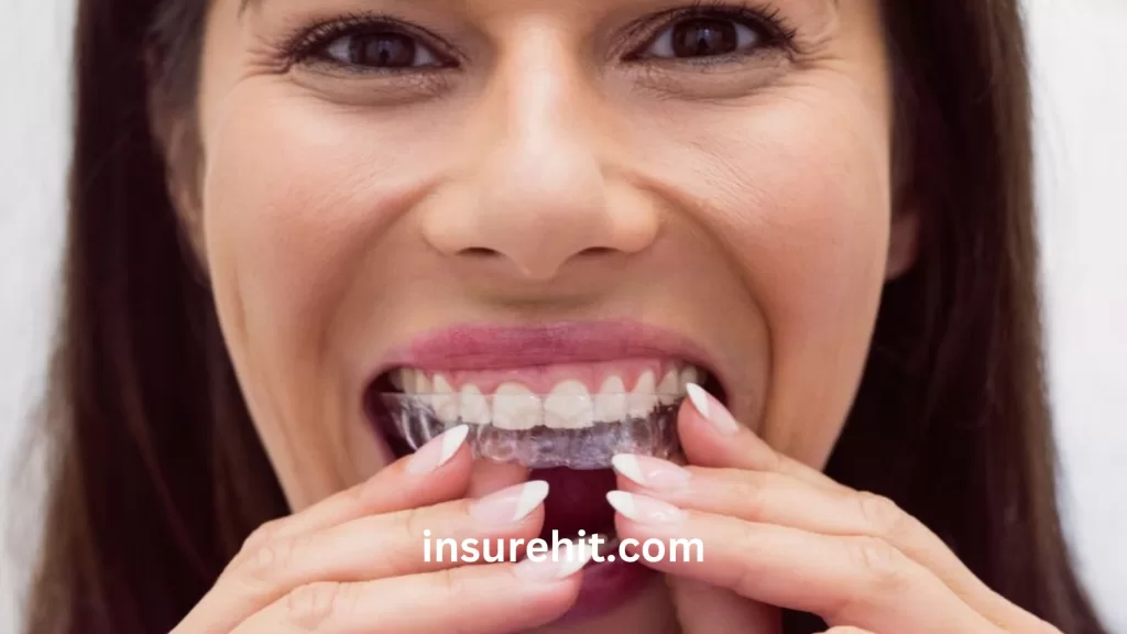 Can Insurance Cover Veneers